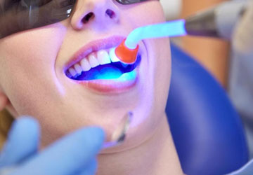 blanqueamiento dental blanqueamiento dental