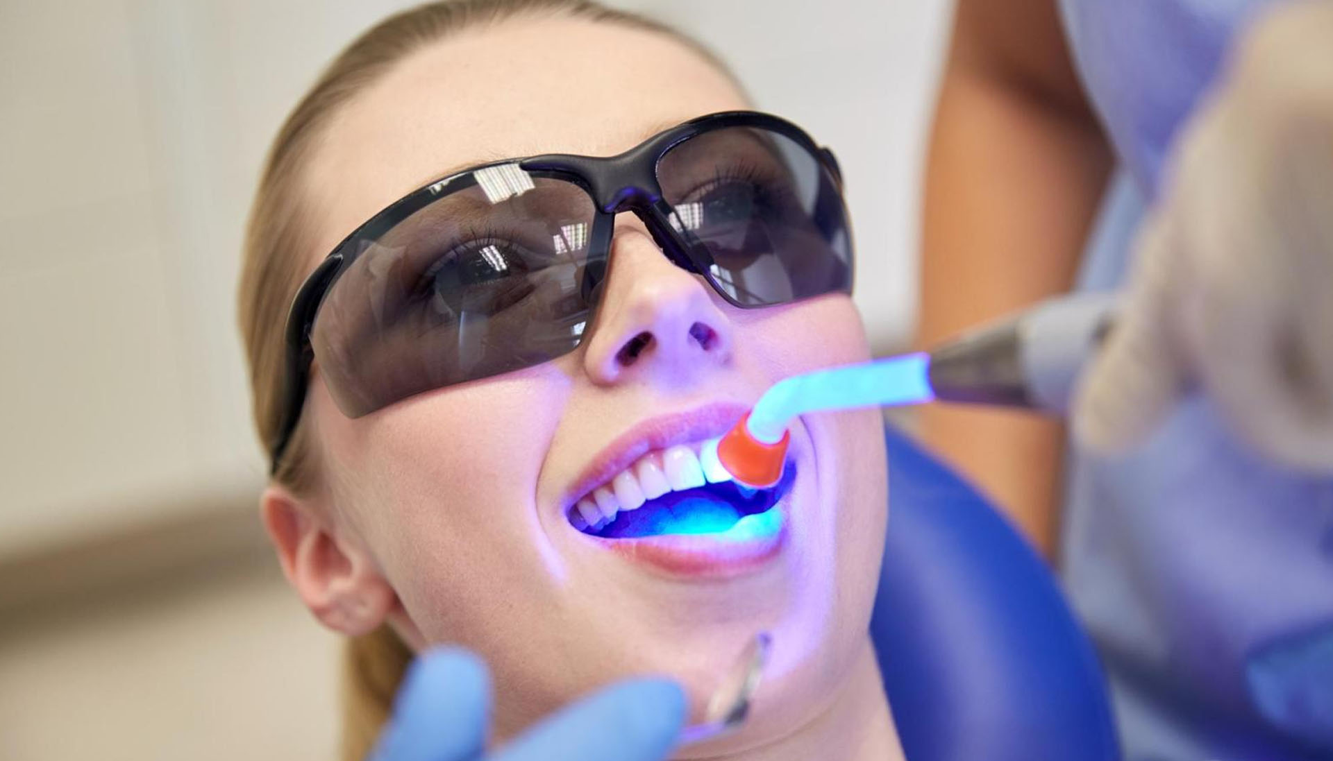 blanqueamiento y limpieza dental