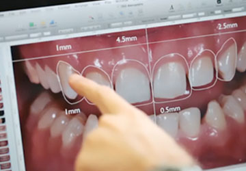 diseño-digital-sonrisa diseño-digital-sonrisa