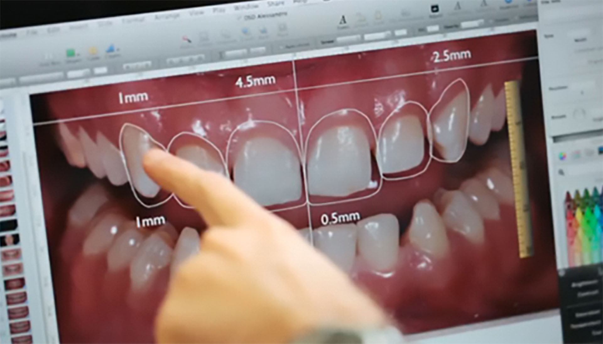 diseño sonrisa salamanca 2