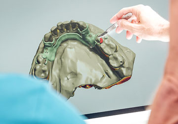 implantologia guiada ordenador implantologia guiada ordenador