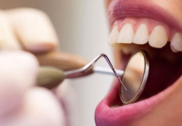 periodoncia-