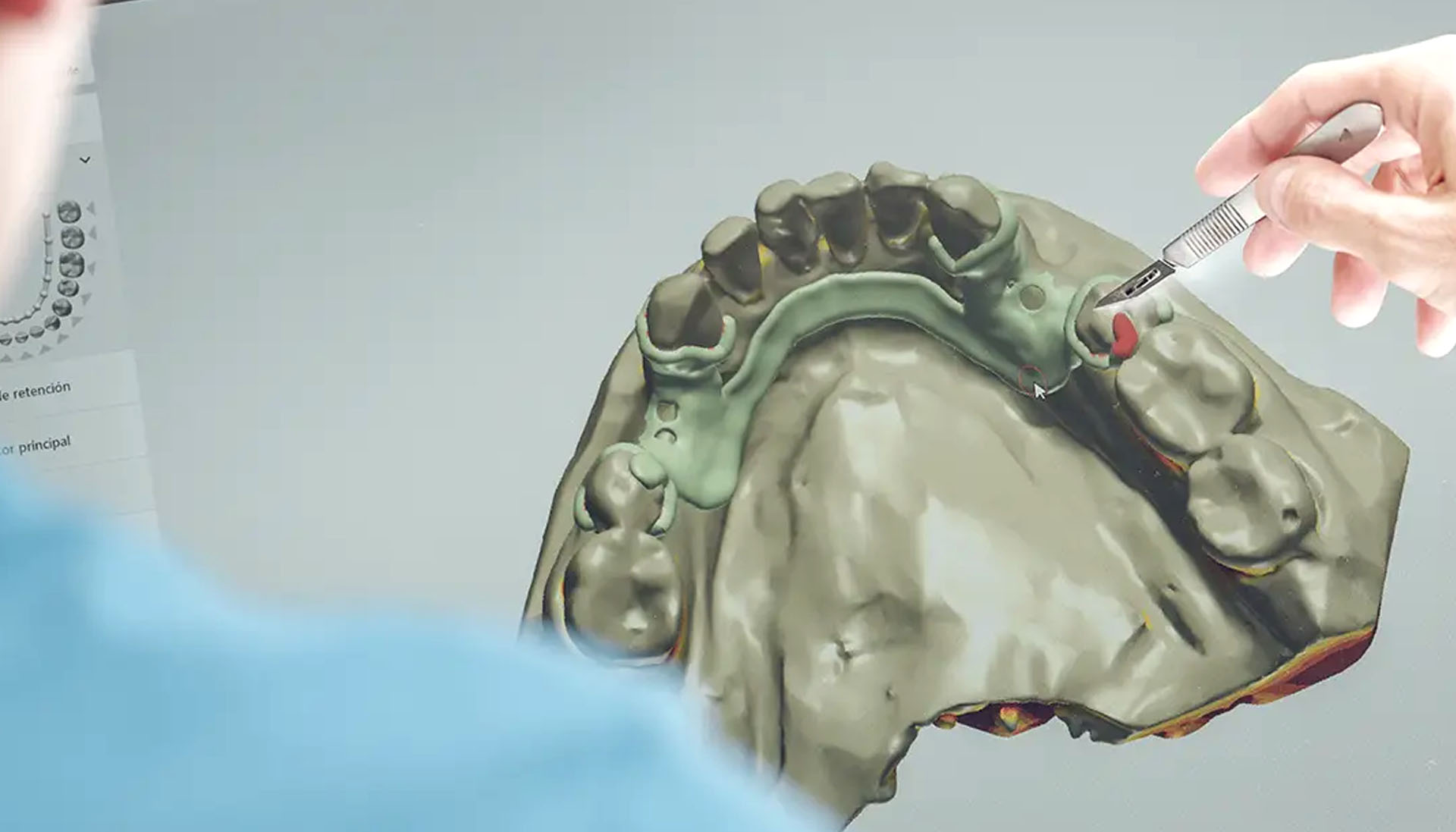 periodoncia avanzada