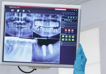 rehabilitacion oral digital rehabilitacion oral digital